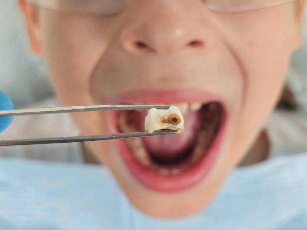 Best Emergency Broken Tooth Repair in Lynwood, CA